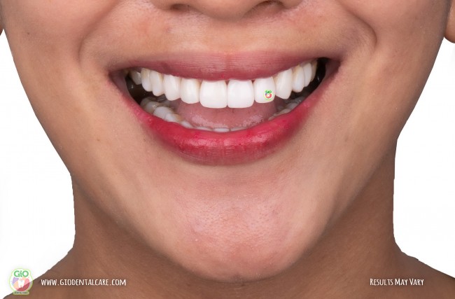 get-your-smile-here--1